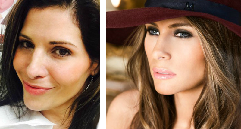 'Melania Makeover' the next hot trend in plastic surgery